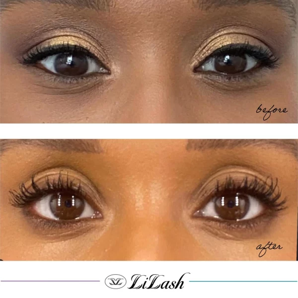 lilash serum for longer lashes